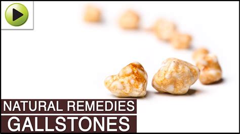 Natural Remedies For GallStone - Natural Health