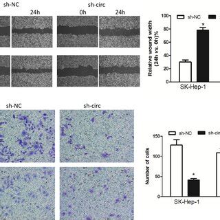 Knockdown Of Hsa Circ Inhibits Hcc Cell Metastasis In Intro