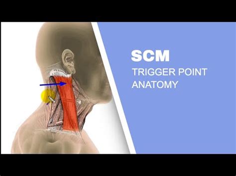 The Best Sternocleidomastoid Stretch (SCM)