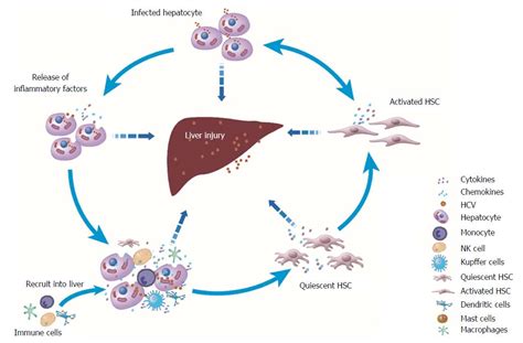 Hepatitis C From Inflammatory Pathogenesis To Anti Inflammatory