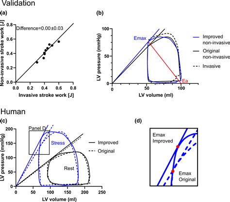 Noninvasive Quantification Of Pressurevolume Loops From