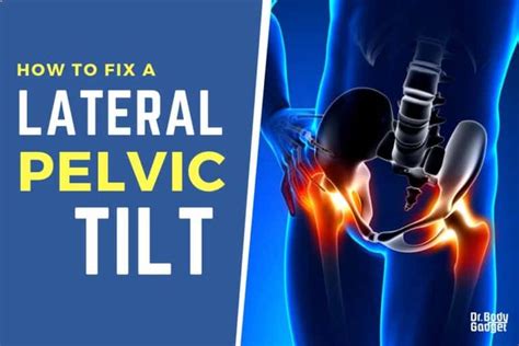 How To Fix A Lateral Pelvic Tilt And Balance Your Uneven Hips Pelvic