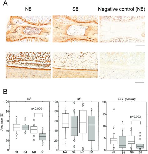 Immunohistochemical Staining For Type Ii Collagen A Immunostaining