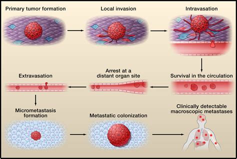 Tumor Metastasis Molecular Insights And Evolving Paradigms Cell