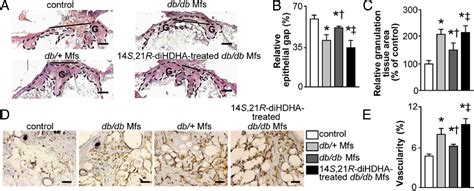 Autacoid S R Dihydroxy Docosahexaenoic Acid Counteracts Diabetic