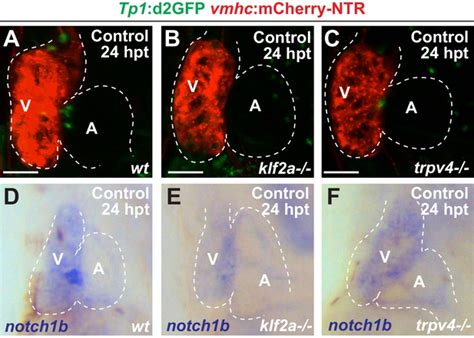 Figures And Data In Hemodynamic Mediated Endocardial Signaling Controls