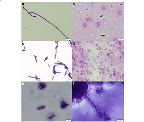 Phenotypic Electron Microscopic Examination Of The Morphology Of