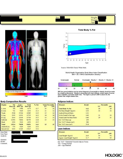 DXA Scan - Shape Up! Studies