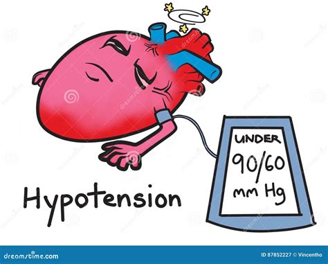 Que Es La Hipotension Arterial