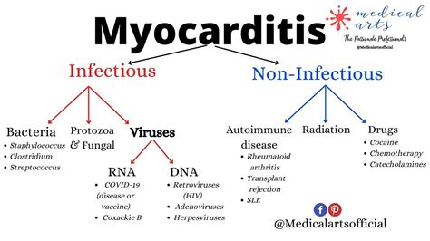 Myocarditis Explained Heart Muscle Inflammation Definition Types