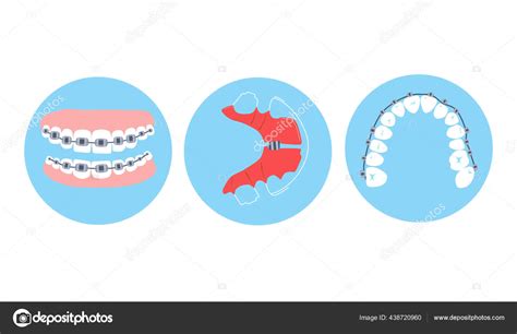 Frenos Dentales Retenedores Metal Alineación Ortodoncia Los Dientes