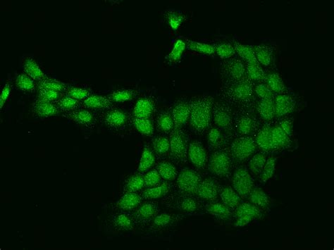 Beta 2 Microglobulinb2m Antibody Mouse Mab