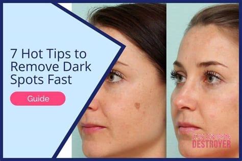 7 Hot Tips To Remove Dark Spots Fast Even Out Skintone