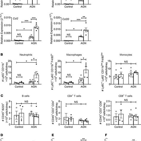 Increased Inflammatory Gene Expression And Cell Infiltration In The