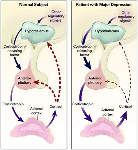 Hypothalamic Dysfunction