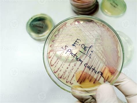 Microbiologist Holding Petri Dish For Sputum Culture Test Showing A