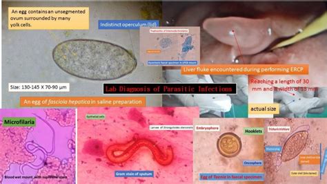 Parasitic Infections Lab Diagnosis: Introduction, Importance and ...