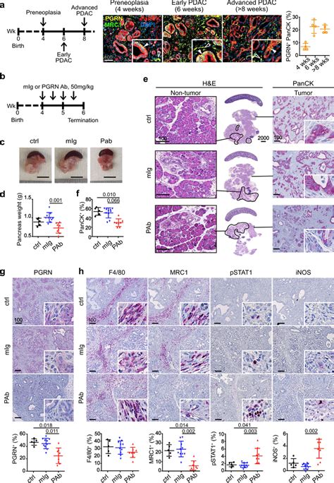 In Vivo PGRN Blockade Suppresses Tumor Initiation And Progression In