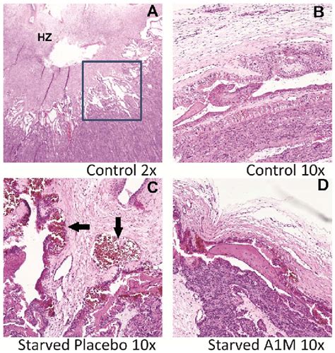 Placenta Cross Section Histology