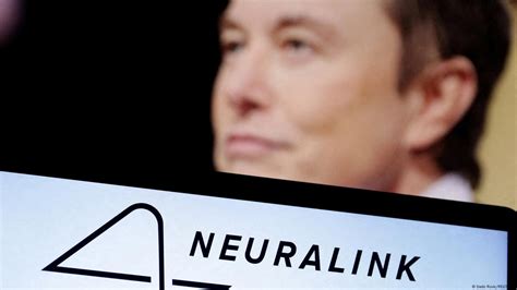 Musks Neuralink Implants Brain Chip In First Human Dw 01302024