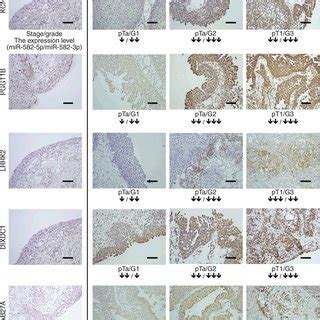 Representative Examples Of Immunohistochemical Expression Of Different