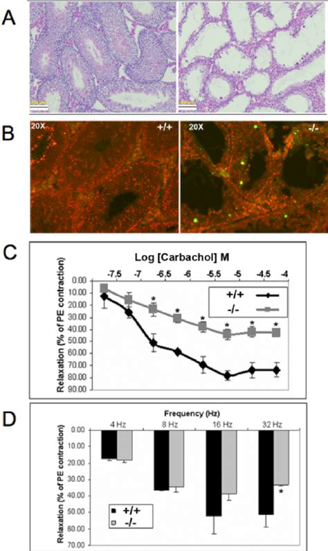 Age Related Impaired Spermatogenesis And Decreased Relaxant Response In