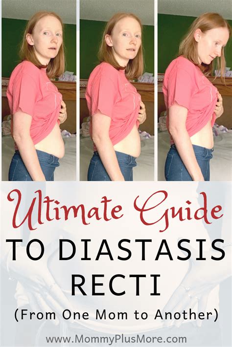 Ultimate Guide To Diastasis Recti Aka Mama Pooch Mommy Plus More