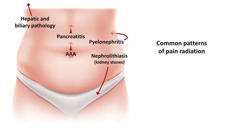 Women Pain In Lower Left Side Of Abdomen Female / Stabbing Pain In The Left Groin In Females ...