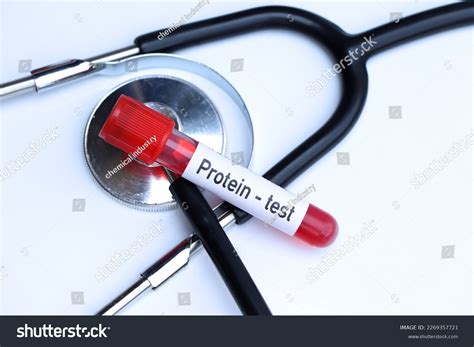 Protein Test Look Abnormalities Blood Blood Stock Photo 2269357721 ...