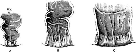Rectum And Anal Canal In Fetus Vintage Illustration Vector