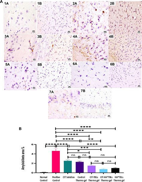 PDF Brain Targeting Of Citicoline Sodium Via Hyaluronic Acid