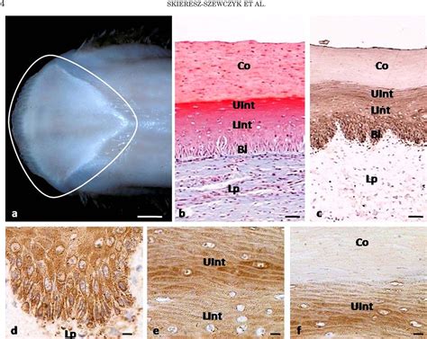 Figure 1 From Localization Of Alpha Keratin And Beta Keratin Corneous