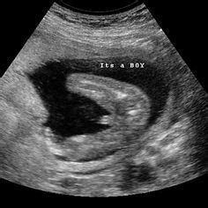 16 weeks pregnant ultrasound