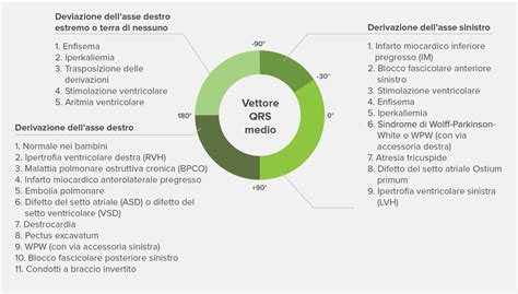 Come Interpretare LECG MESI Simplifying Diagnostics