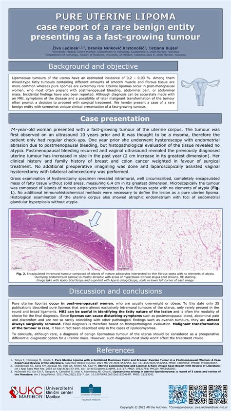 PDF PURE UTERINE LIPOMA Case Report Of A Rare Benign Entity