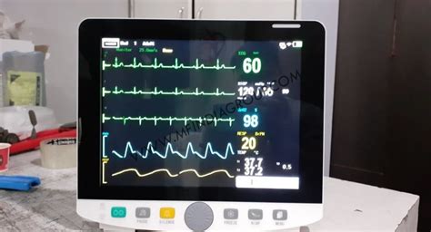 Cardiac And Multi Parameter Patient Monitor Display Size 12 Inch Tft