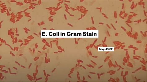 Escherichia Coli Simple Stain Best Sale | cdlguaiba.com.br