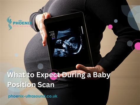 What to Expect During a Baby Position Scan