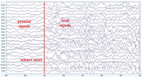 Frontiers An Effective Fusion Model For Seizure Prediction GAMRNN