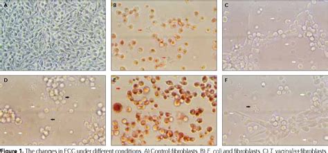 Figure 1 From The Cytopathic Effects Of Trichomonas Vaginalis On Fibroblast Cell Culture Alone