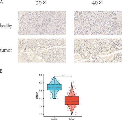 Validation of external GNG7 expression. A Immunohistochemical staining ...