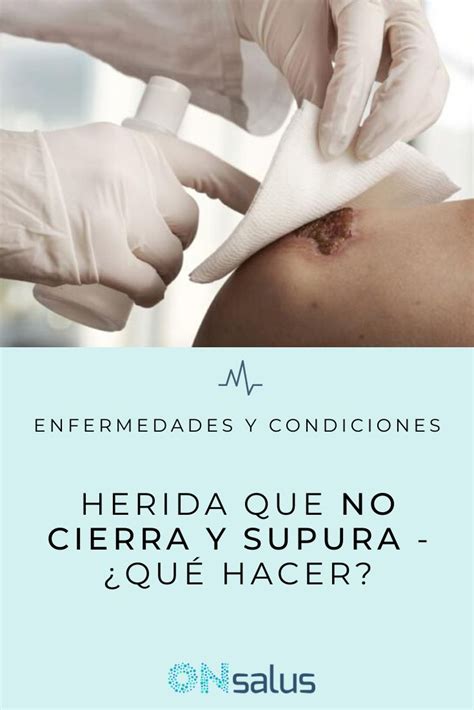 Herida Que No Cierra Y Supura ¿qué Hacer Causas Y Tratamiento