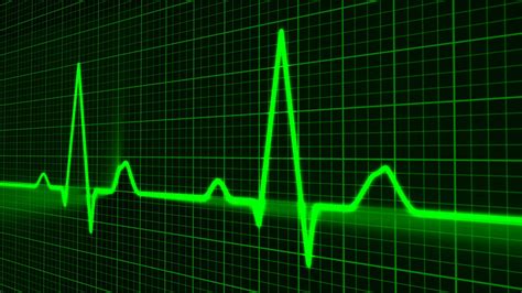 Heart Cardiogram Free Stock Photo Public Domain Pictures