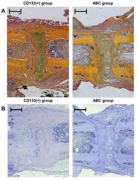 Histological Analysis Of Bone Formation And Revascularization In The