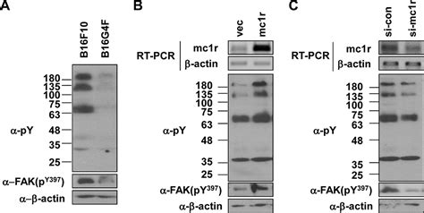 Melanocortin 1 Receptor Regulates Melanoma Cell Migration By