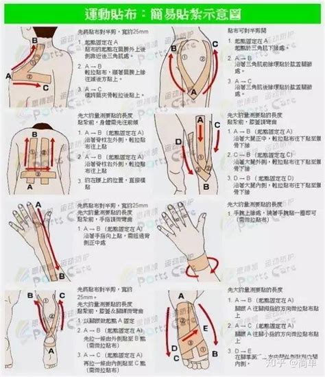 纯干货 肌内效贴布使用大法，学完没有不会用的 知乎