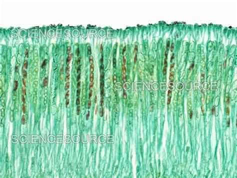 Peziza Under Microscope Labeled