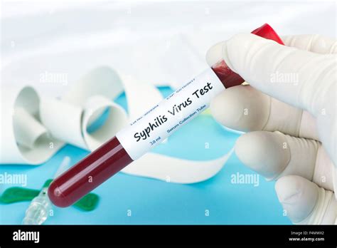 Syphilis Hi Res Stock Photography And Images Alamy