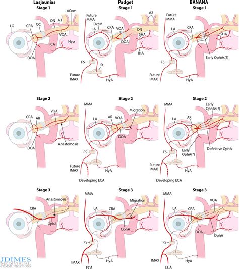 Superior Hypophyseal Arteries Angiographic Re Discovery Comprehensive