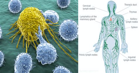 The Lymphatic System Is How Cancer Spreads - Here Are 10 Ways To Keep It Flowing Healthy.